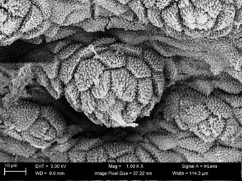 Media type: image;   Invertebrate Zoology 32029 Description: SEM image of specimen.;  Aspect: dorsal